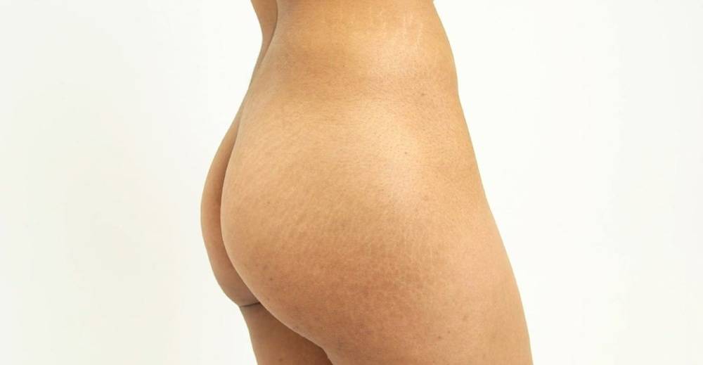 Mia Khalifa Nude Body Anatomy photo Leaked - #10